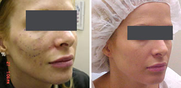 woman face before and after patient right side photo 4