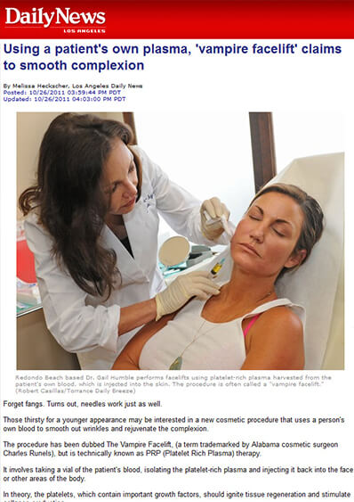 Los Angeles Daily News interview with Dr. Humble about the Vampire Facelift photo