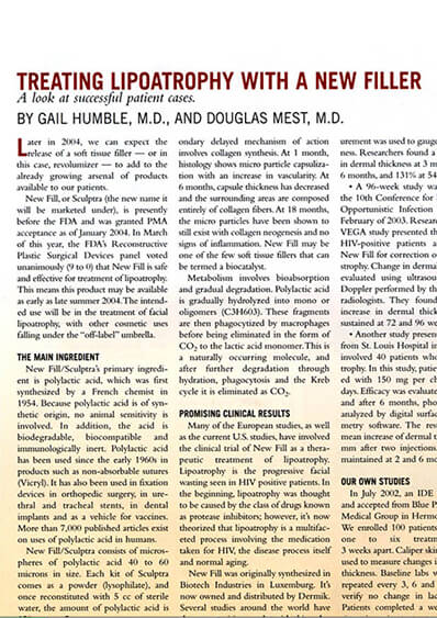 Treating Lipoatrophy with a new filler journal banner